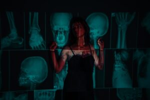 body composition scan